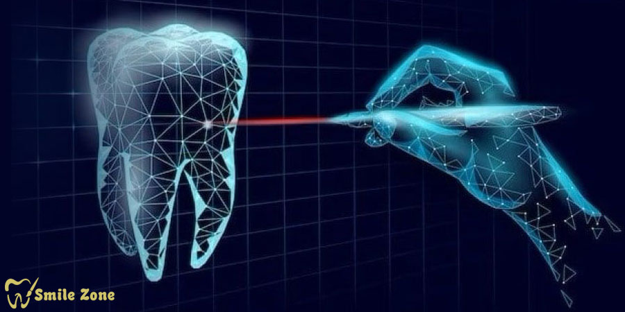 قدرت هوش مصنوعی برای پیشبینی و پیشگیری از پوسیدگی دندان