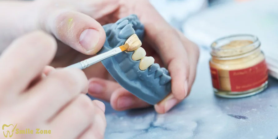 بررسی جدیدترین مواد نانو ترمیمی در دندانپزشکی